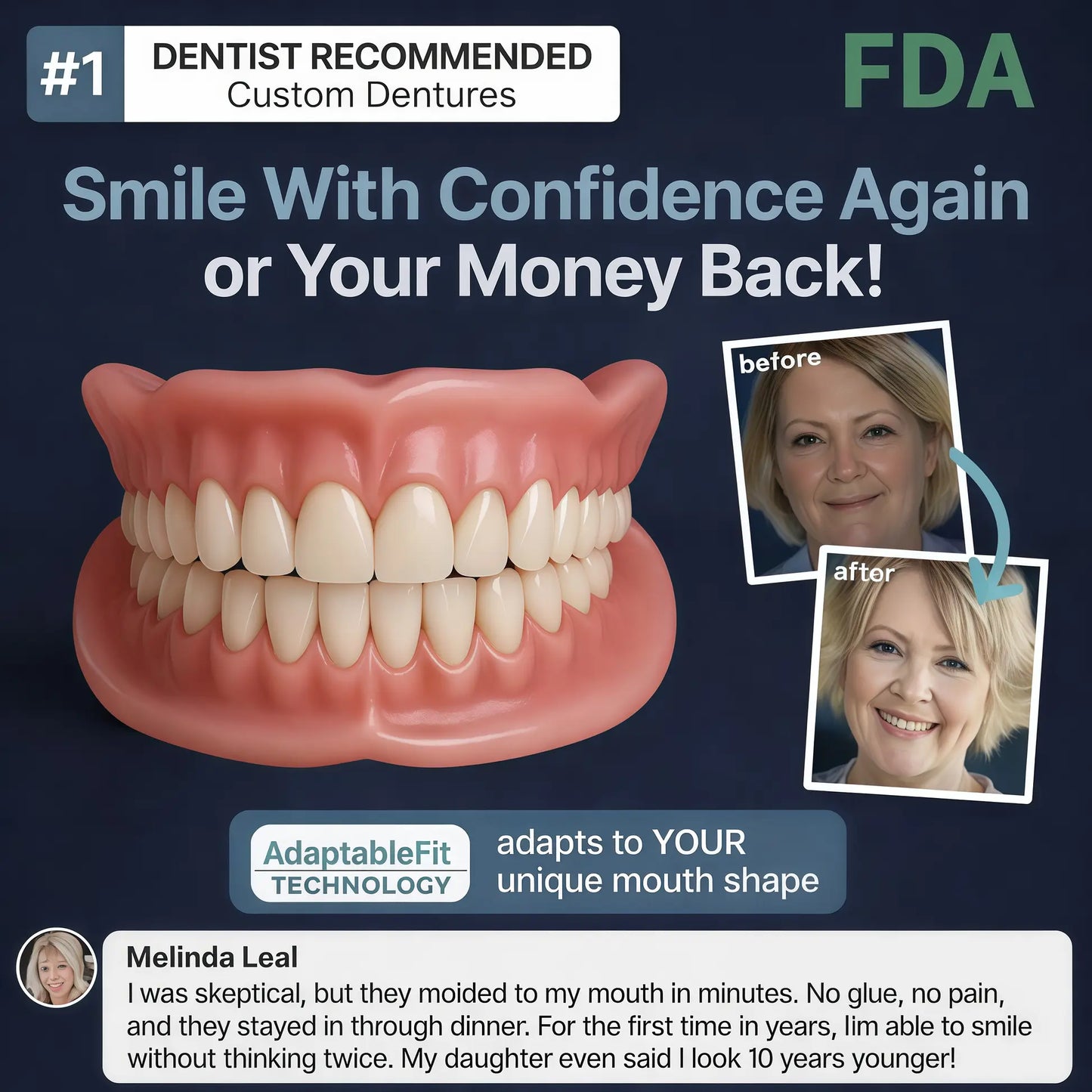 Newly upgraded second-generation YagooTM complete dentures