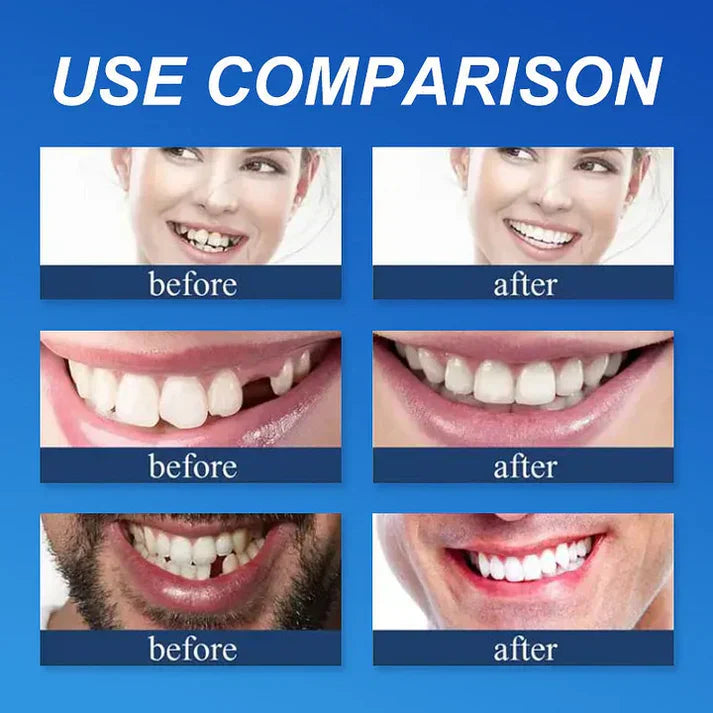 🏆Ends Today: Exclusive Smile Care Offer! 🏆2026 Bestselling Product🦷 Fresh Smile Comfort, Say Goodbye to Wearing Discomfort!🌎
