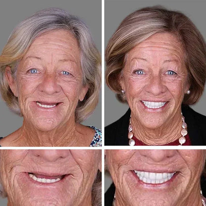 🏆Ends Today: Exclusive Smile Care Offer! 🏆2026 Bestselling Product🦷 Fresh Smile Comfort, Say Goodbye to Wearing Discomfort!🌎