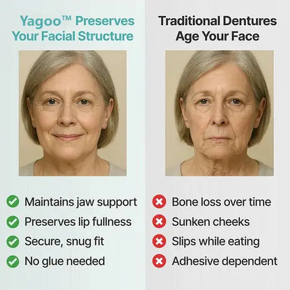 YAGOOTM Custom-Fit Full Functional Dentures
